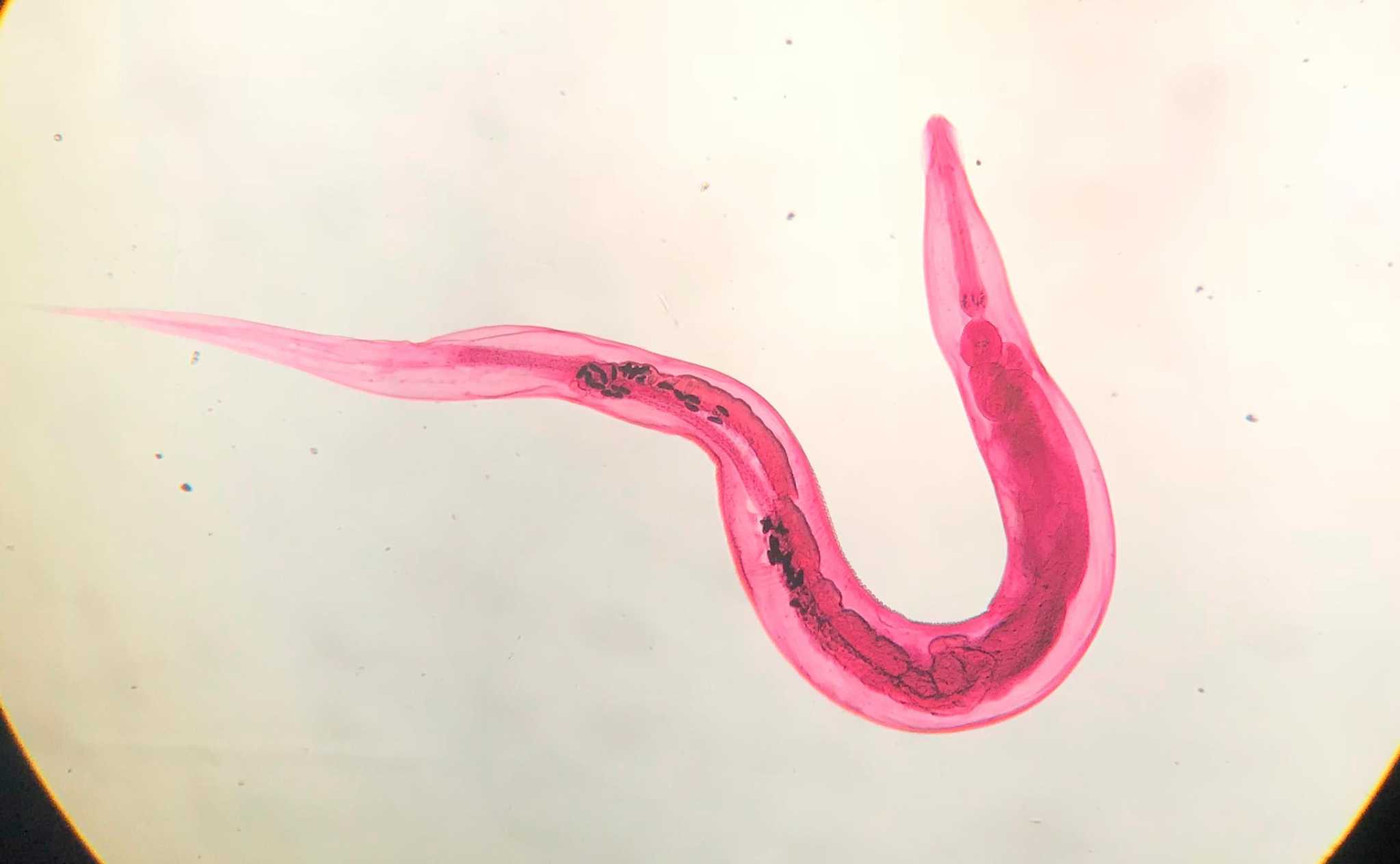 Pinworm under a microscope